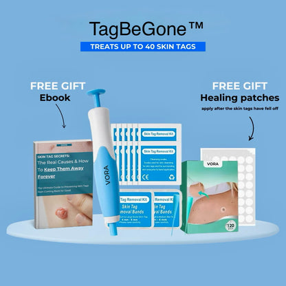 TagBeGone™ – Easy Skin Tag Removal