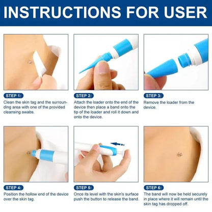 TagBeGone™ – Easy Skin Tag Removal